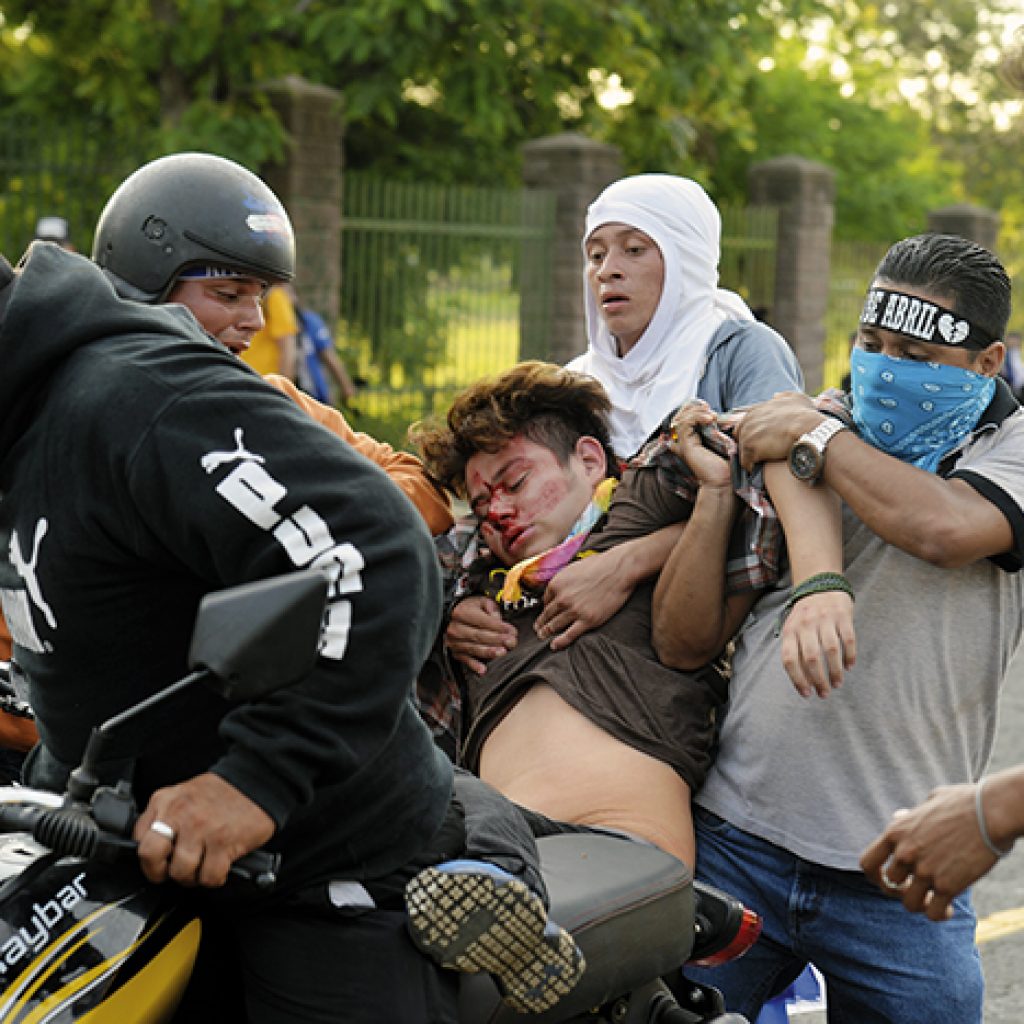 One person was injured in an attack by government paramilitary groups against the civilian population that was marching peacefully accompanying the Mothers of April.  Photo Jader Flores/ THE PRESS