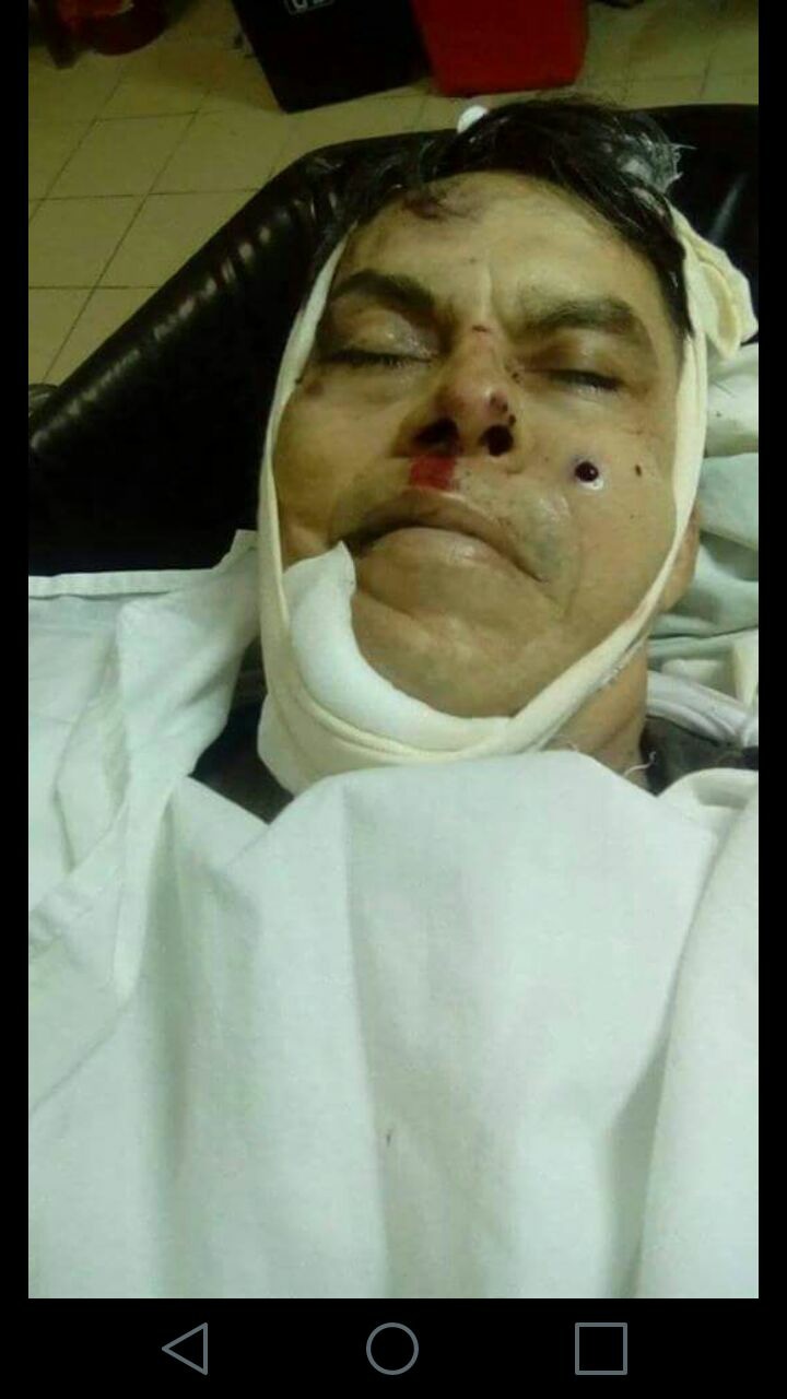Miguel Ángel Ramos Rivera, alias "Franklin" murió cuando atacaba el tranque de La Trinidad en un escuadrón conjunto de policías y paramilitares orteguistas. Foto: Facebook.