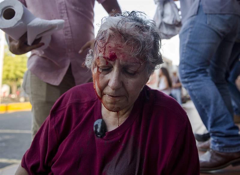 Ana Quitós tras ser agredida por los fanáticos del Frente Sandinista. Foto: Confidencial