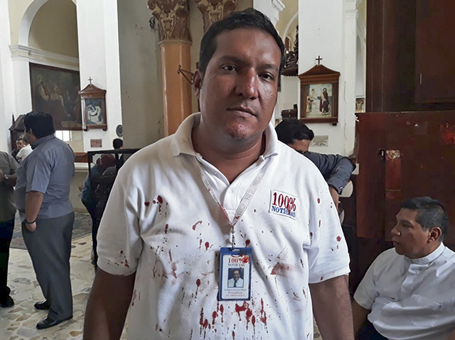 El periodista Jackson Orozco, fue golpeado salvajemente por paramilitares sandinistas. Foto/Cortesía