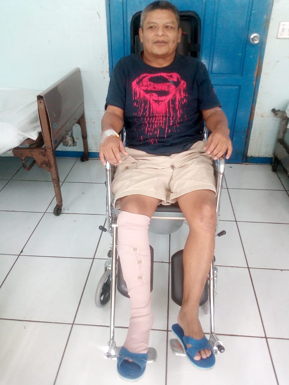 Max Cruz, preso político que fue tiroteado por paramilitares orteguistas. Corre riesgo de perder su pierna derecha. Foto: Cortesía.