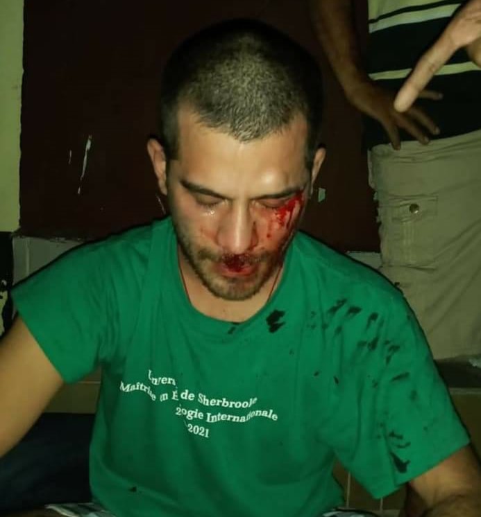 Hermano de Amaya Coppens agredido por paramilitares. Foto: Cortesía