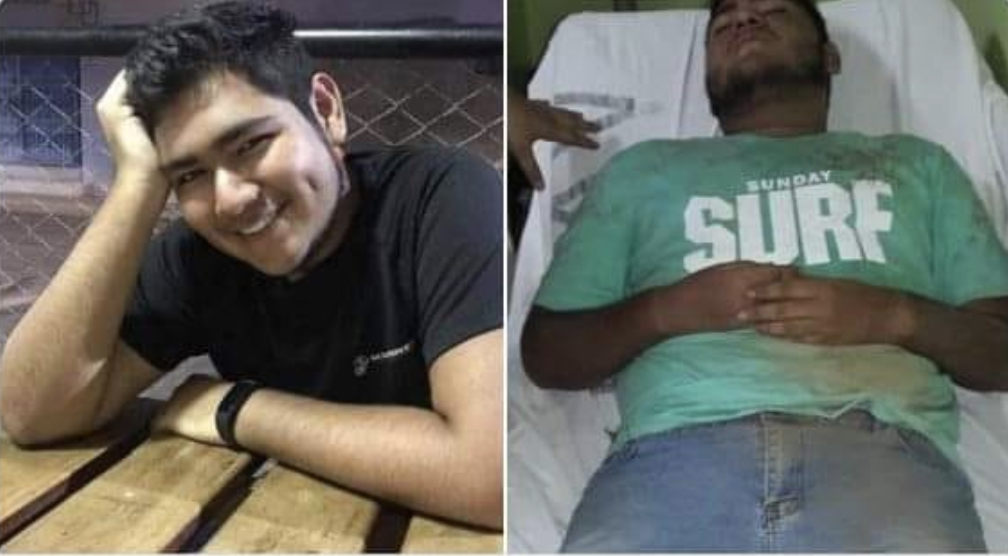 Joven universitario de la UCA aparece tirado en la carretera a Tisma tres días después golpeado y con signos de tortura 