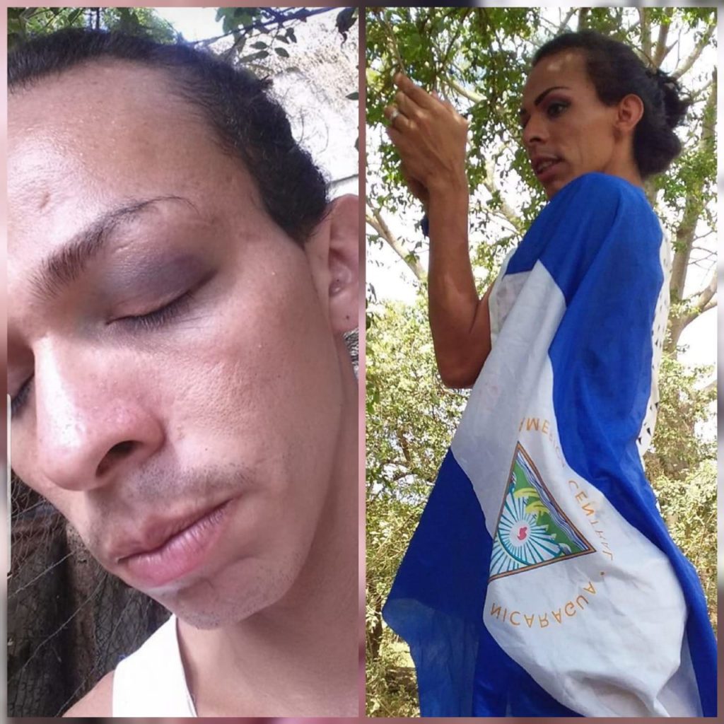 «Lady La Vulgaraza» denuncia agresiones por parte de orteguistas