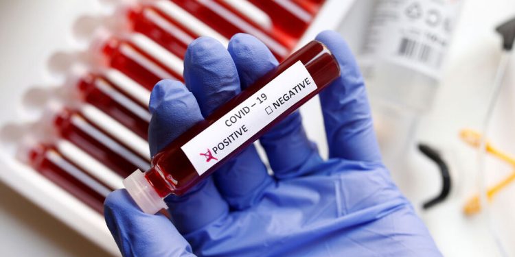 Algunas de las pruebas rápidas para detectar el coronavirus. Foto: Reuters