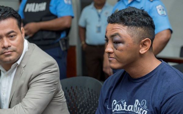 Nicaragua, en lista negra por usar la tortura para silenciar a las voces disidentes