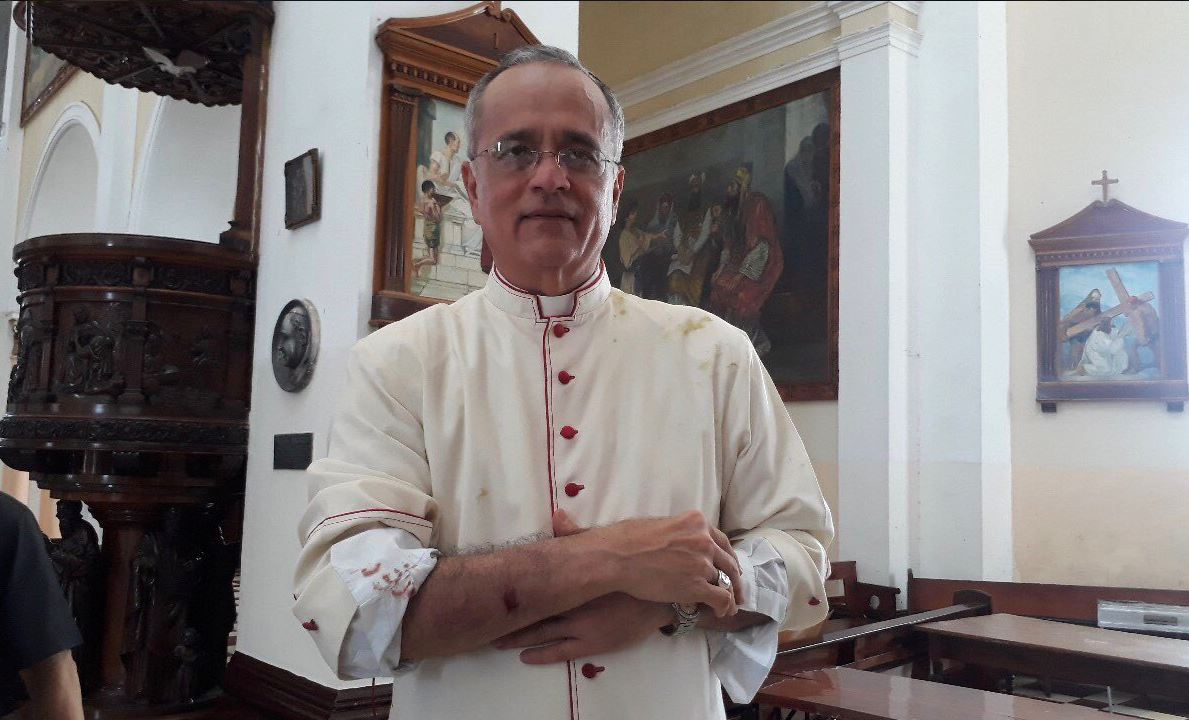 Monseñor Silvio Báez, obispo auxiliar, resultó con golpes y una herida en su brazo derecho. Foto: La Prensa 