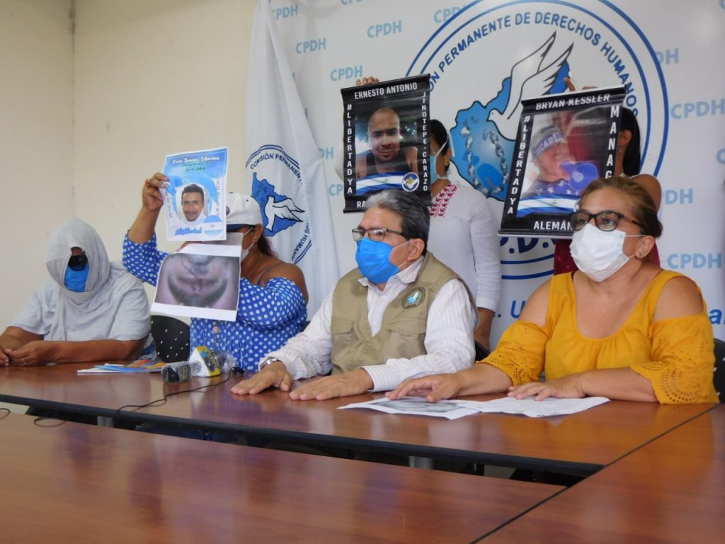 Tres presos políticos se cosieron los labios con hilos de nailon como parte de su huelga de hambre