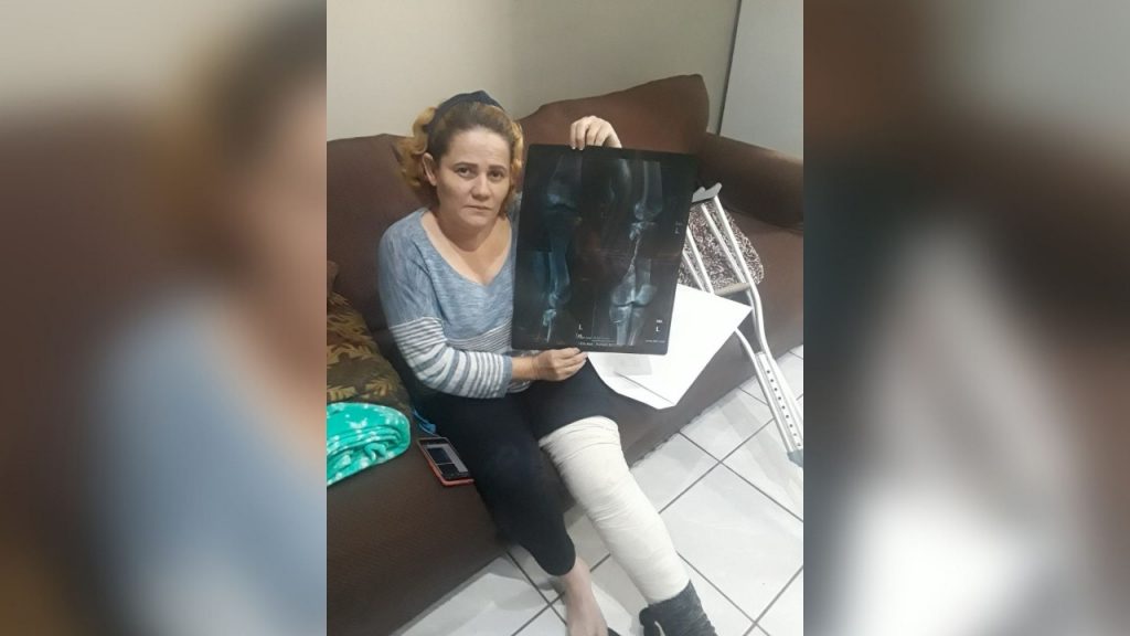Karen Lacayo necesita intervención quirúrgica para salvar su rodilla. Foto: Artículo 66 / Cortesía