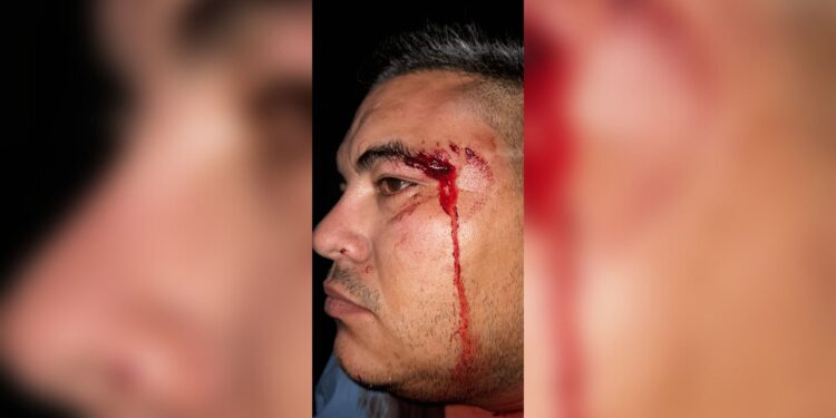 Médico que atendió a víctimas de Ortega se exilio tras ser agredido por fanáticos orteguistas