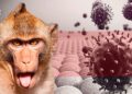 Alerta mundial por aparición de casos de la viruela del mono en Europa y EEUU