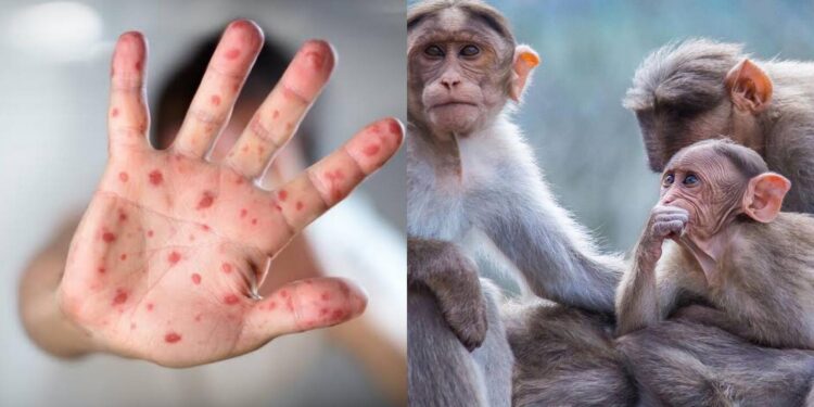 Confirman el primer caso de viruela del mono en Taiwán