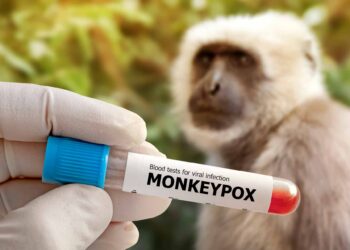 EEUU inicia a realizar pruebas para detectar casos de Viruela del Mono