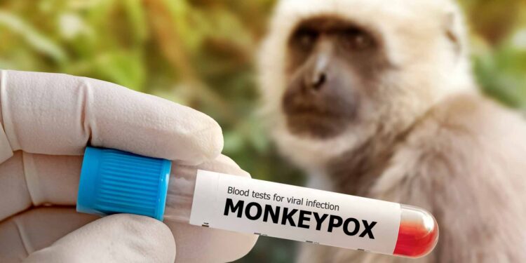 EEUU inicia a realizar pruebas para detectar casos de Viruela del Mono