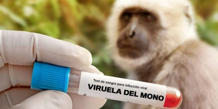 El Salvador registra 40 casos de viruela símica, sin reportar fallecidos