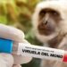 El Salvador registra 40 casos de viruela símica, sin reportar fallecidos