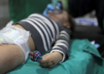 Un equipo de cirugía opera a un niño rescatado de los escombros de un edificio en un hospital en la ciudad de Harim, en la provincia de Idlib, en el noroeste de Siria, controlada por los rebeldes, en la frontera con Turquía, el 10 de febrero de 2023, después de un terremoto mortal. - Tras el terremoto de magnitud 7,8 que sacudió Turquía y Siria el 6 de febrero, derribando cientos de edificios y dejando un saldo de al menos 3.581 muertos en Siria, los suministros han tardado en llegar al país devastado por la guerra donde años de conflicto han devastado la sistema de salud, especialmente en las áreas controladas por los rebeldes en el noroeste del país. (Foto de Aaref WATAD / AFP)