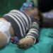 Un equipo de cirugía opera a un niño rescatado de los escombros de un edificio en un hospital en la ciudad de Harim, en la provincia de Idlib, en el noroeste de Siria, controlada por los rebeldes, en la frontera con Turquía, el 10 de febrero de 2023, después de un terremoto mortal. - Tras el terremoto de magnitud 7,8 que sacudió Turquía y Siria el 6 de febrero, derribando cientos de edificios y dejando un saldo de al menos 3.581 muertos en Siria, los suministros han tardado en llegar al país devastado por la guerra donde años de conflicto han devastado la sistema de salud, especialmente en las áreas controladas por los rebeldes en el noroeste del país. (Foto de Aaref WATAD / AFP)