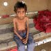 NOTA DEL EDITOR: Contenido gráfico / Hassan Razem, un niño de diez años que sufre de desnutrición aguda grave, aparece en una foto en el distrito de Abs de la provincia noroccidental de Hajjah en Yemen, el 25 de julio de 2022.