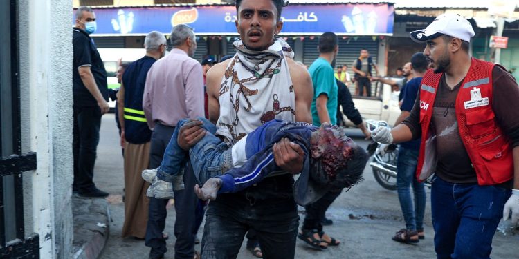 NOTA DEL EDITOR: Contenido gráfico / Un niño gravemente herido es trasladado a un hospital tras un ataque israelí en Rafah, en el sur de la Franja de Gaza, el 6 de noviembre de 2023, en medio de las batallas en curso entre Israel y el movimiento palestino Hamas. - Miles de civiles, tanto palestinos como israelíes, han muerto desde el 7 de octubre de 2023, después de que militantes palestinos de Hamás con base en la Franja de Gaza entraran en el sur de Israel en un ataque sin precedentes que desencadenó una guerra declarada por Israel a Hamás con bombardeos de represalia en Gaza. (Foto de SAID KHATIB / AFP)