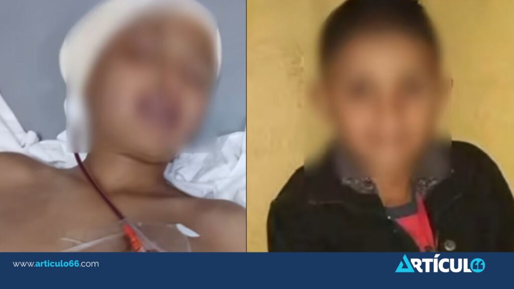 Madre exige justicia tras agresión con pedrada que dejó a su hijo en estado crítico en Estelí
