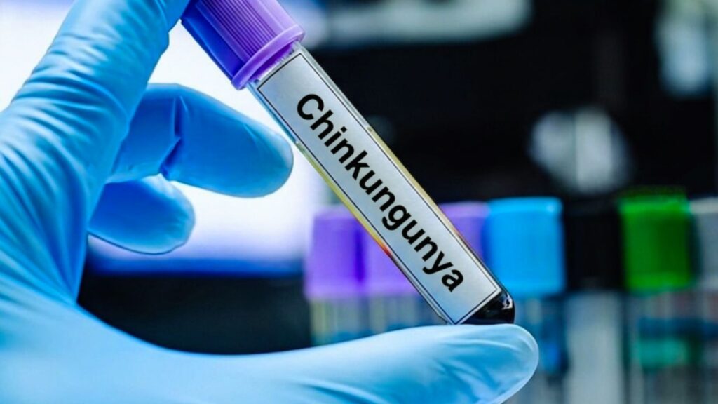 Téllez acusa al régimen de ignorar la epidemia del chikungunya